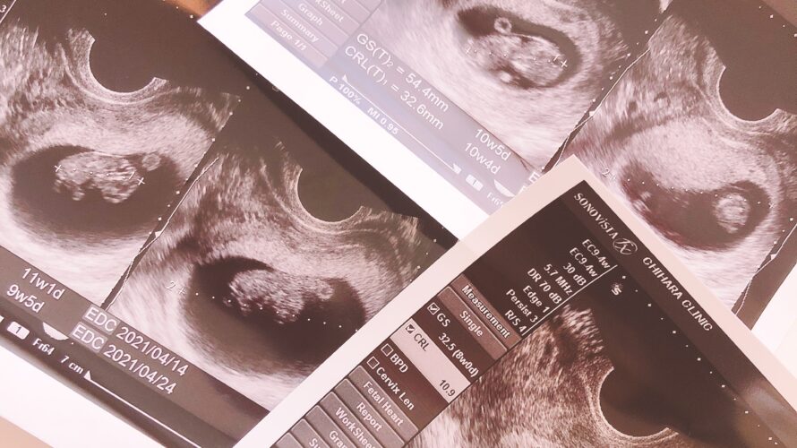 《C》Just born ②